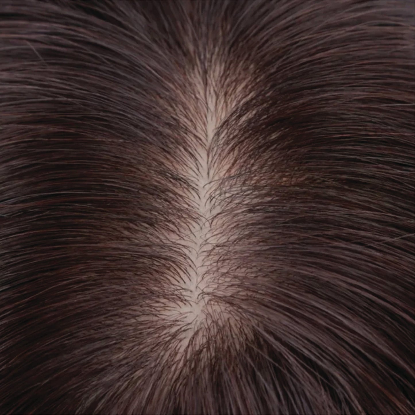 🔥Last Day:84% Off🔥Silk Base Human Hair Topper